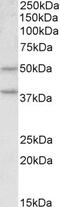 Corticosteroid-binding globulin antibody, 42-429, ProSci, Enzyme Linked Immunosorbent Assay image 