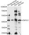 Zinc Finger Protein 621 antibody, LS-C749628, Lifespan Biosciences, Western Blot image 