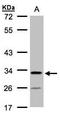 Chromosome 4 Open Reading Frame 19 antibody, TA309023, Origene, Western Blot image 