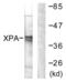 XPA, DNA Damage Recognition And Repair Factor antibody, abx013252, Abbexa, Western Blot image 