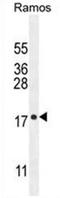 Chromosome 11 Open Reading Frame 53 antibody, AP50431PU-N, Origene, Western Blot image 