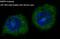 Matrix metalloproteinase-9 antibody, M00139, Boster Biological Technology, Immunofluorescence image 