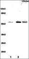 Recombination Signal Binding Protein For Immunoglobulin Kappa J Region antibody, orb101350, Biorbyt, Western Blot image 