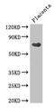 Centrosomal Protein 70 antibody, CSB-PA836778LA01HU, Cusabio, Western Blot image 