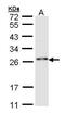 RING finger protein 114 antibody, PA5-21815, Invitrogen Antibodies, Western Blot image 