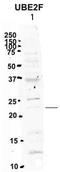 Ubiquitin Conjugating Enzyme E2 F (Putative) antibody, TA340244, Origene, Western Blot image 