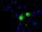Microseminoprotein Beta antibody, NBP2-02450, Novus Biologicals, Immunofluorescence image 