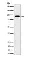 Intraflagellar Transport 88 antibody, M06814, Boster Biological Technology, Western Blot image 