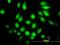 Protein O-Mannose Kinase antibody, H00084197-M03, Novus Biologicals, Immunocytochemistry image 