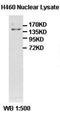 Replication factor C subunit 1 antibody, orb77596, Biorbyt, Western Blot image 