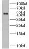 Beaded Filament Structural Protein 2 antibody, FNab00885, FineTest, Western Blot image 