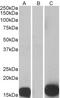 Peroxiredoxin 2 antibody, 45-122, ProSci, Enzyme Linked Immunosorbent Assay image 