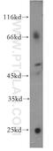 Colony Stimulating Factor 2 Receptor Alpha Subunit antibody, 18307-1-AP, Proteintech Group, Western Blot image 