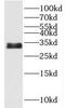 Unique cartilage matrix-associated protein antibody, FNab09225, FineTest, Western Blot image 