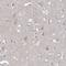 Rho GTPase Activating Protein 44 antibody, PA5-58550, Invitrogen Antibodies, Immunohistochemistry paraffin image 