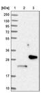 Ubiquitin Conjugating Enzyme E2 E1 antibody, NBP1-86886, Novus Biologicals, Western Blot image 
