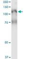 Phospholipase C Like 2 antibody, H00023228-M02, Novus Biologicals, Immunoprecipitation image 