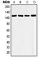 Histone Deacetylase 9 antibody, LS-C353208, Lifespan Biosciences, Western Blot image 