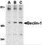 BECN1 antibody, 3611, ProSci Inc, Western Blot image 