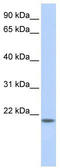 Chromosome 20 Open Reading Frame 203 antibody, TA341537, Origene, Western Blot image 