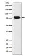 REL Proto-Oncogene, NF-KB Subunit antibody, M01880, Boster Biological Technology, Western Blot image 