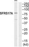 A-Kinase Anchoring Protein 17A antibody, TA312916, Origene, Western Blot image 