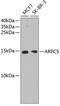 Actin Related Protein 2/3 Complex Subunit 5 antibody, 13-981, ProSci, Western Blot image 