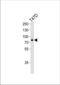 Exostosin Glycosyltransferase 2 antibody, TA325104, Origene, Western Blot image 