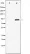 LIM Domain Kinase 1 antibody, TA325620, Origene, Western Blot image 
