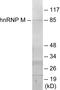 Heterogeneous Nuclear Ribonucleoprotein M antibody, EKC1738, Boster Biological Technology, Western Blot image 
