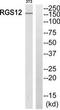 Regulator Of G Protein Signaling 12 antibody, TA314445, Origene, Western Blot image 