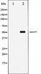 Microphthalmia-associated transcription factor antibody, orb99401, Biorbyt, Western Blot image 