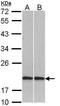 Cofilin 2 antibody, orb73743, Biorbyt, Western Blot image 