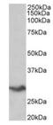 V-Set Domain Containing T Cell Activation Inhibitor 1 antibody, orb12987, Biorbyt, Western Blot image 