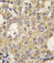 Poly(ADP-Ribose) Glycohydrolase antibody, abx033299, Abbexa, Immunohistochemistry paraffin image 