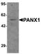 Pannexin 1 antibody, TA319871, Origene, Western Blot image 