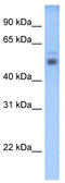 STEAP3 Metalloreductase antibody, TA331539, Origene, Western Blot image 