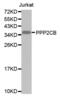 Protein Phosphatase 2 Catalytic Subunit Beta antibody, abx002243, Abbexa, Western Blot image 
