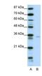 Zinc Finger Protein 177 antibody, NBP1-80299, Novus Biologicals, Western Blot image 