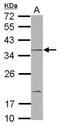 Notch 2 N-Terminal Like A antibody, GTX117659, GeneTex, Western Blot image 