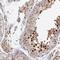 Protein Serine Kinase H1 antibody, NBP2-49105, Novus Biologicals, Immunohistochemistry frozen image 