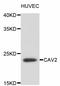 Caveolin-2 antibody, abx125306, Abbexa, Western Blot image 