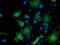 ADP-ribosylation factor GTPase-activating protein 1 antibody, MA5-25445, Invitrogen Antibodies, Immunocytochemistry image 