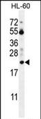 Prothymosin Alpha antibody, PA5-71580, Invitrogen Antibodies, Western Blot image 