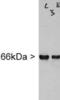Internexin Neuronal Intermediate Filament Protein Alpha antibody, MA3-16726, Invitrogen Antibodies, Western Blot image 
