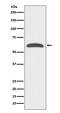 Forkhead Box O4 antibody, M01819-1, Boster Biological Technology, Western Blot image 