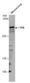 Nucleoprotein TPR antibody, GTX130142, GeneTex, Western Blot image 