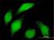 BUB1 Mitotic Checkpoint Serine/Threonine Kinase antibody, H00000699-M01, Novus Biologicals, Immunocytochemistry image 