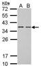 B-cell CLL/lymphoma 7 protein family member A antibody, GTX100197, GeneTex, Western Blot image 
