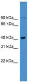 UBX Domain Protein 6 antibody, TA342560, Origene, Western Blot image 